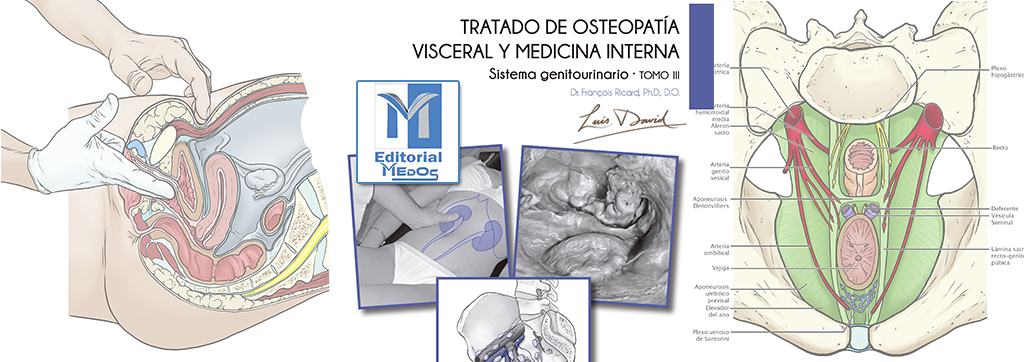 MONTAJE BLOG MEDOS VISCERAL 3